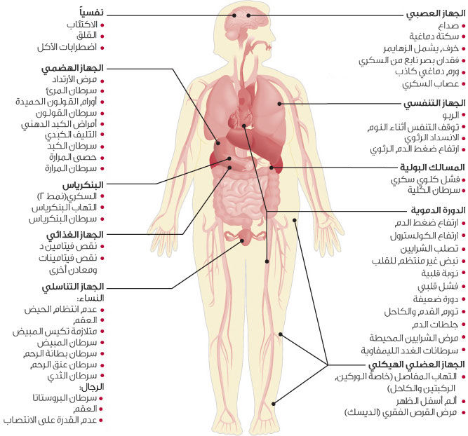 علاج السمنة المفرطة ومرض السكر عالم حواء