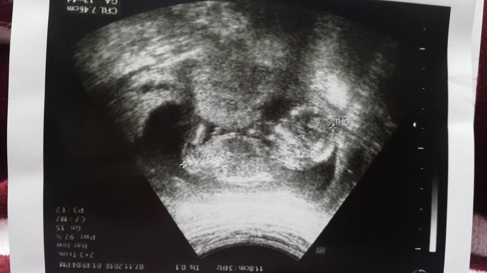 التجمع الرابع لمواليد مايو يونيو ٢٠١٩ الصفحة 262 عالم حواء